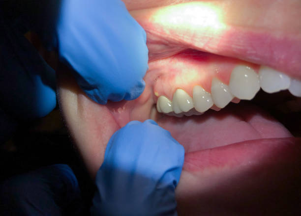 Best Emergency Orthodontic Repairs in Gibson, AR